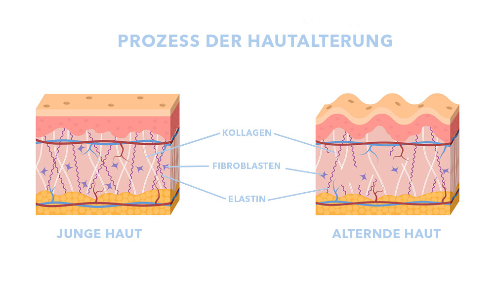 Prozess der Hautalterung